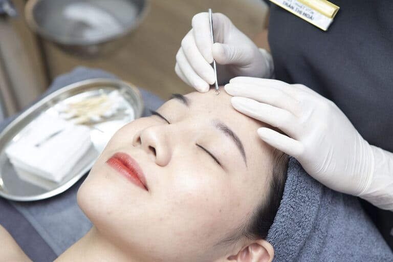 nặn mụn spa gò vấp uy tín