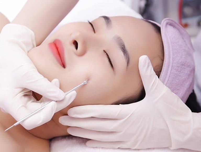 spa trị mụn tphcm