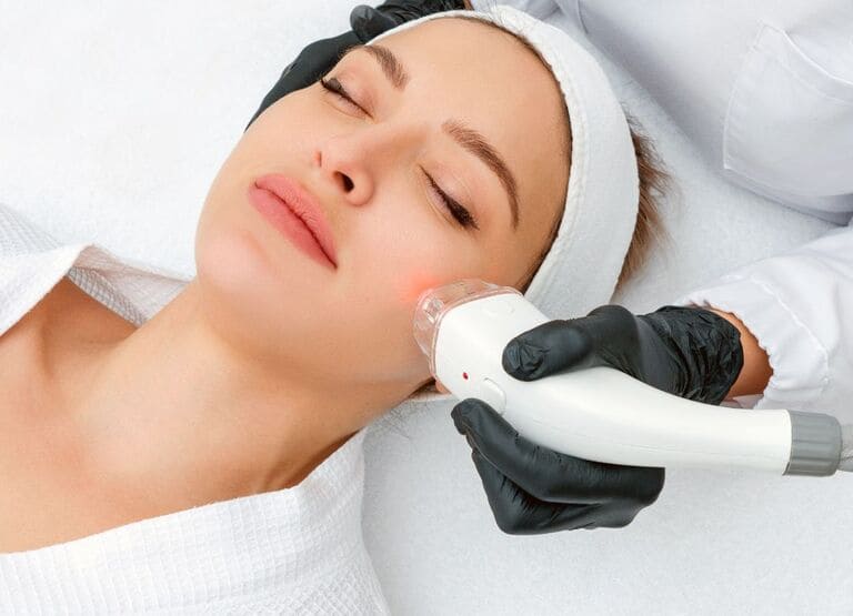 giá trị thâm mụn tại spa là bao nhiêu