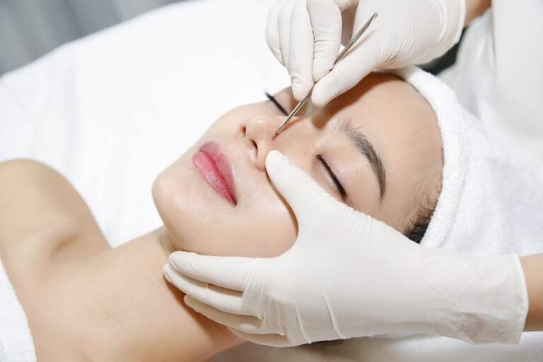 nặn mụn có đau hay không