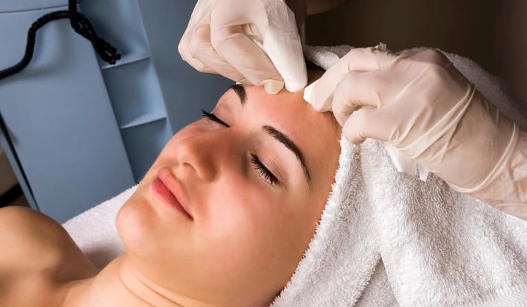 nặn mụn có đau không