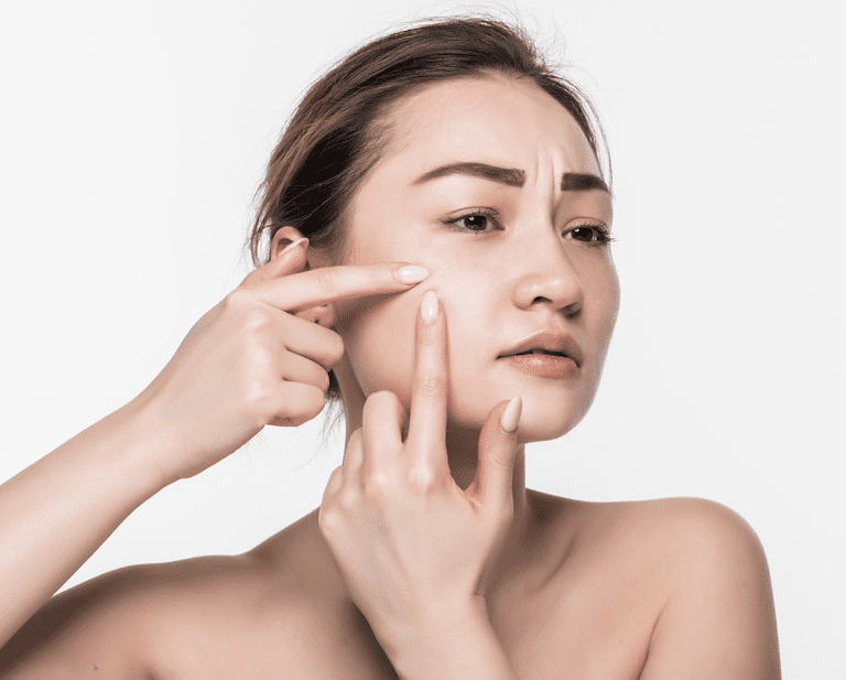 spa nặn mụn quận 9