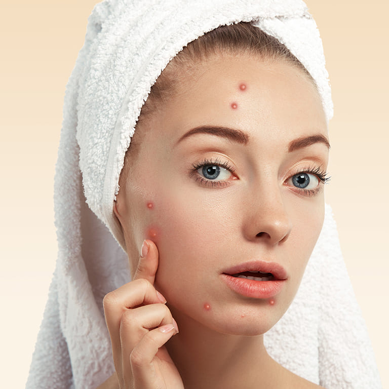 nặn mụn quận 9