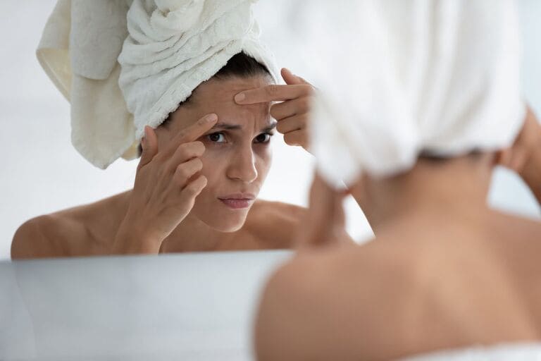 sau sinh nặn mụn được không